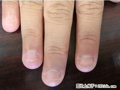 剪指甲、挖耳屎，这些日常小动作竟隐藏大危害！ - 阿拉尔生活资讯 - 阿拉尔28生活网 ale.28life.net